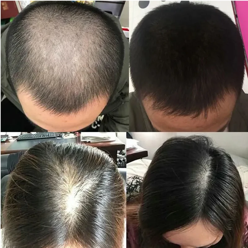 Overlord Bitkisel Saç Uzatma S - Hair Care Or Haircare incelemesi ve fiyatı